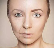 皮肤松弛衰老，应怎样保养？